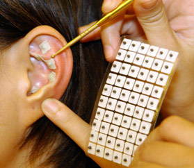 Auriculotherapie spécialité du Naturopathe avec le Collège de Naturopathie Ressourcée - CNR